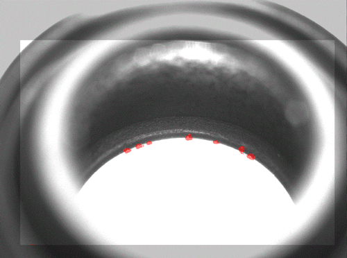 Deep Learning - Ret&eacute;n de goma &Oslash;9 mm Control de labios interiores